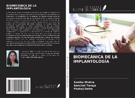 BIOMECÁNICA DE LA IMPLANTOLOGÍA