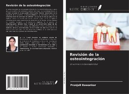 Revisión de la osteointegración