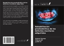 Rehabilitación prostodóntica de los defectos maxilares adquiridos