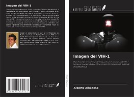 Imagen del VIH-1