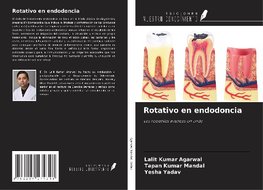 Rotativo en endodoncia