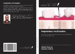 Implantes inclinados