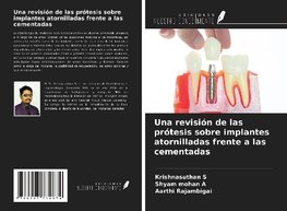 Una revisión de las prótesis sobre implantes atornilladas frente a las cementadas