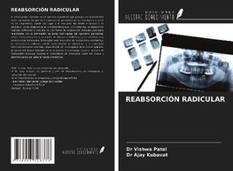 REABSORCIÓN RADICULAR