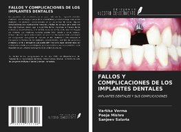 FALLOS Y COMPLICACIONES DE LOS IMPLANTES DENTALES