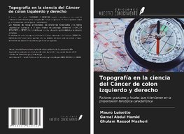 Topografía en la ciencia del Cáncer de colon izquierdo y derecho