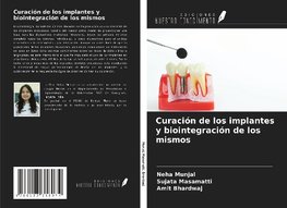 Curación de los implantes y biointegración de los mismos