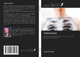 Tuberculosis