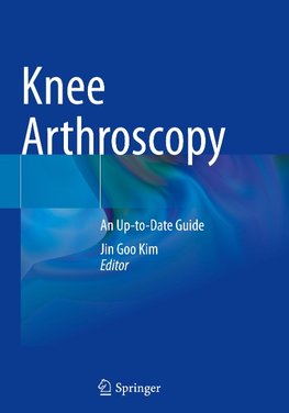 Knee Arthroscopy