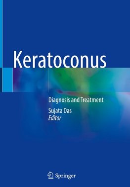 Keratoconus