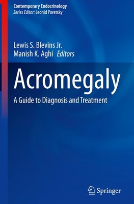 Acromegaly