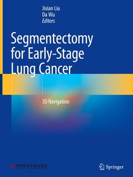 Segmentectomy for Early-Stage Lung Cancer