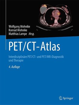 PET/CT-Atlas