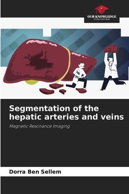 Segmentation of the hepatic arteries and veins