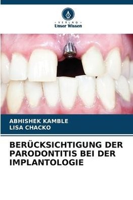 BERÜCKSICHTIGUNG DER PARODONTITIS BEI DER IMPLANTOLOGIE