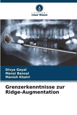 Grenzerkenntnisse zur Ridge-Augmentation