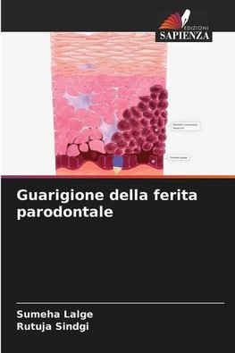 Guarigione della ferita parodontale