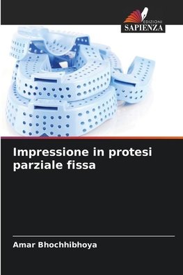 Impressione in protesi parziale fissa