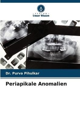 Periapikale Anomalien