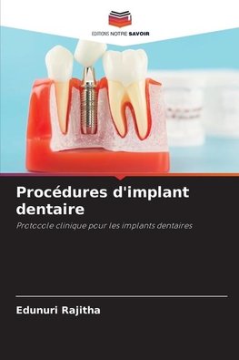 Procédures d'implant dentaire