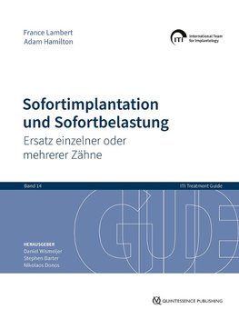 Sofortimplantation und Sofortbelastung