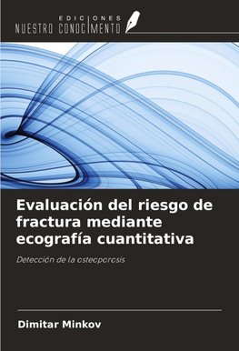 Evaluación del riesgo de fractura mediante ecografía cuantitativa