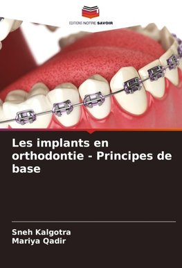 Les implants en orthodontie - Principes de base