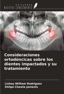 Consideraciones ortodóncicas sobre los dientes impactados y su tratamiento