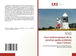 Cure coelioscopique de la jonction pyélo-urétérale chez l¿enfant