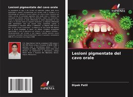 Lesioni pigmentate del cavo orale