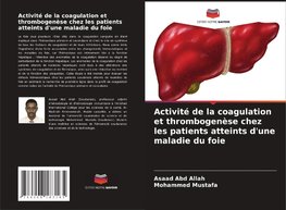 Activité de la coagulation et thrombogenèse chez les patients atteints d'une maladie du foie