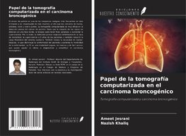 Papel de la tomografía computarizada en el carcinoma broncogénico