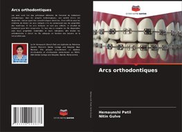 Arcs orthodontiques