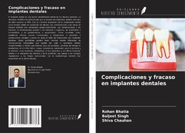 Complicaciones y fracaso en implantes dentales