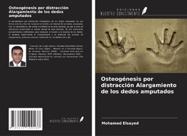 Osteogénesis por distracción Alargamiento de los dedos amputados