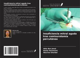 Insuficiencia mitral aguda tras comisurotomía percutánea