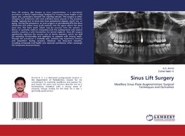 Sinus Lift Surgery