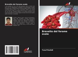 Brevetto del forame ovale