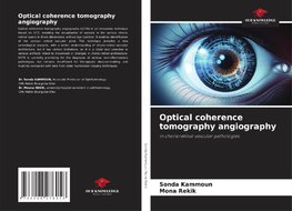 Optical coherence tomography angiography