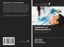 Implantes en odontopediatría