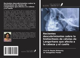 Recientes descubrimientos sobre la histiocitosis de células de Langerhans que afecta a la cabeza y el cuello