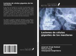 Lesiones de células gigantes de los maxilares