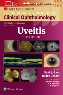 Uveitis, Third edition